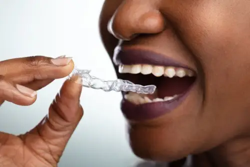 woman holds dental aligner